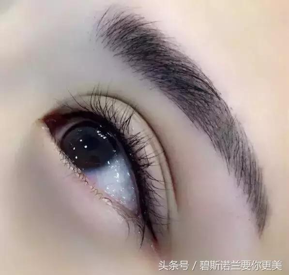 做了美瞳线双眼皮不见了,美瞳线做完1-7天肿胀的对比图