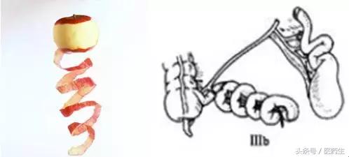 舌尖上的中医药论文,舌尖上的医疗