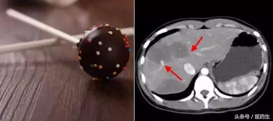 舌尖上的中医药论文,舌尖上的医疗