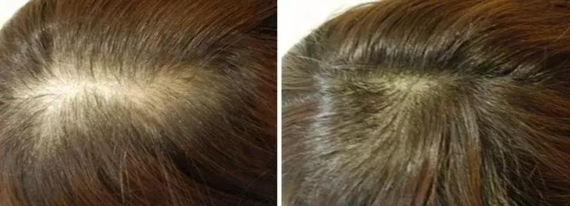 改变发型改变自己好物推荐,发型决定气质好物分享