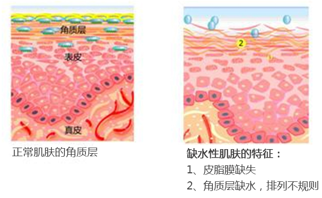 激光对皮肤正常结构的影响