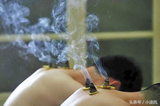 抑郁症艾灸禁忌与关注事项,手术后艾灸禁忌与关注事项