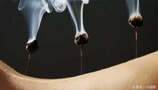 抑郁症艾灸禁忌与关注事项,手术后艾灸禁忌与关注事项