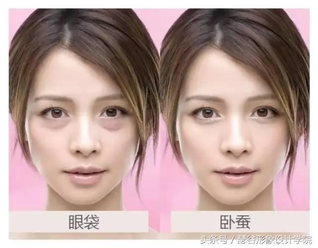 眼袋深最简单的去眼袋的方法,上眼袋大最简单的去眼袋的方法