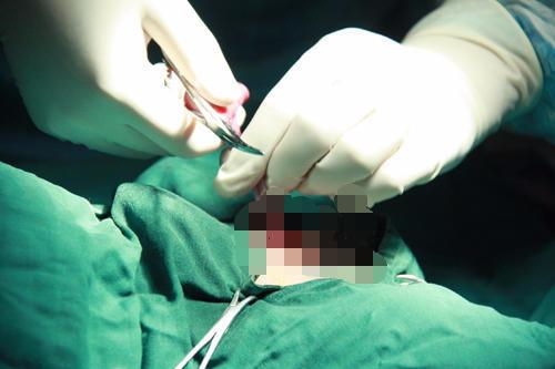 为什么顺产还要挨一刀，听听这些过来妈咪谈感受！