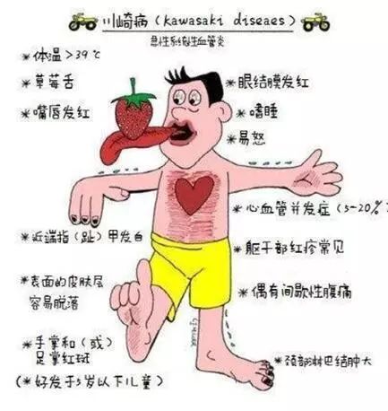 小孩会突发心梗吗,小孩几岁会得心梗