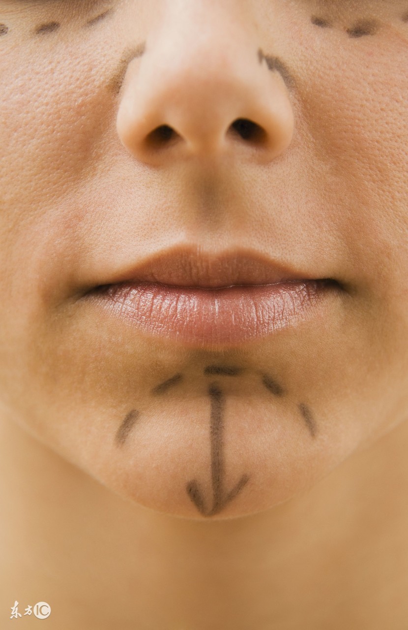 隆鼻的介绍,隆鼻材料大揭秘哪种才更适合你