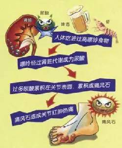 痛风又不能吃药怎么办,得了痛风又想吃又想喝我该怎么办