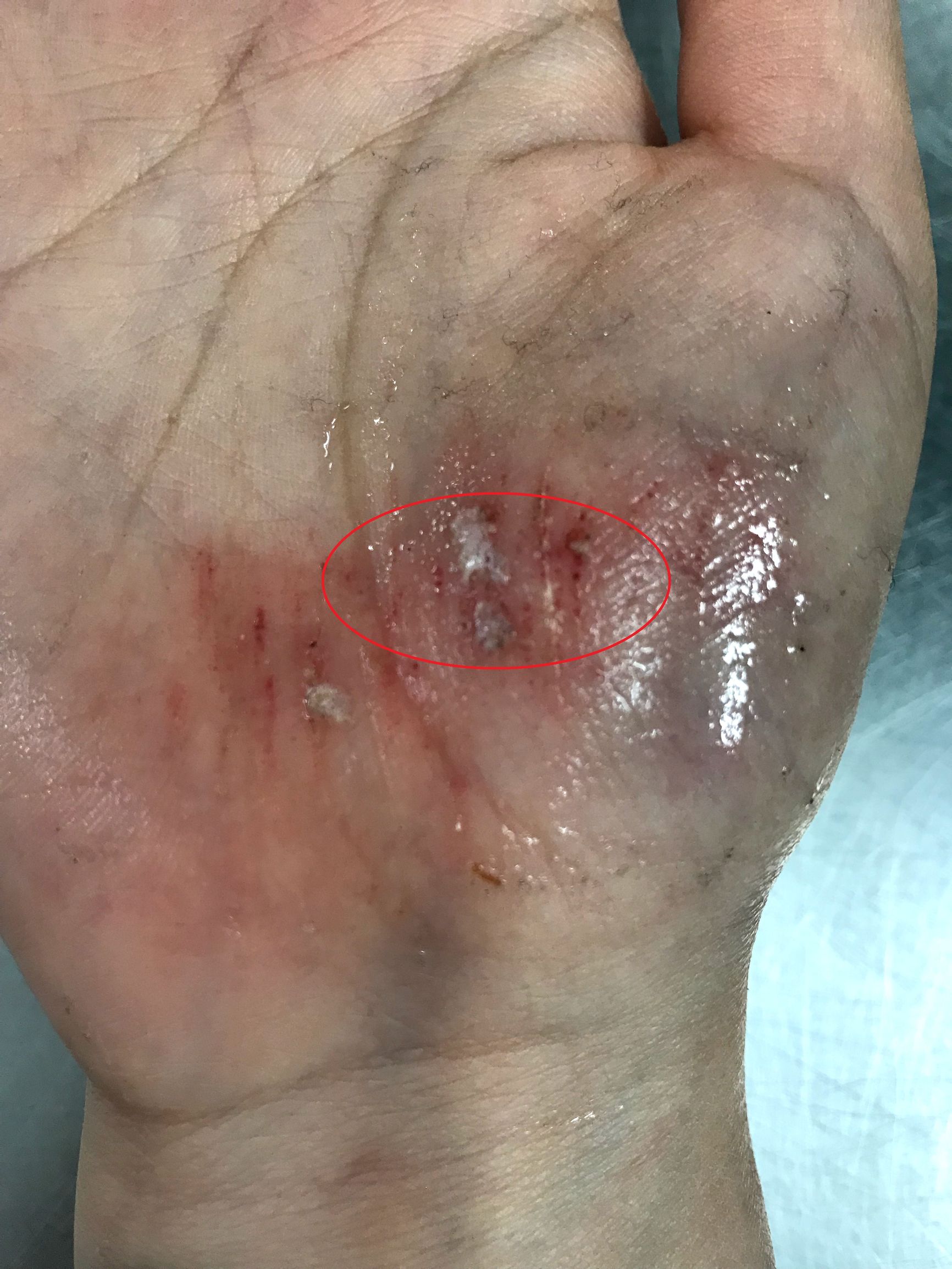 张馨予被狗咬的是哪个节目,张馨予为什么被狗咬伤