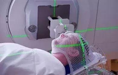 白血病放射治疗的方式,白血病治疗方案一样吗