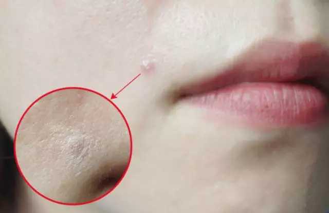 双11最畅销护肤品,双11拔草大牌化妆品