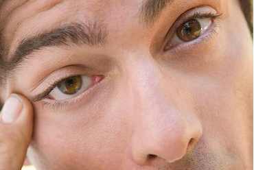 眼皮一直跳有什么办法缓解吗,眼皮一直跳怎么回事喝什么药