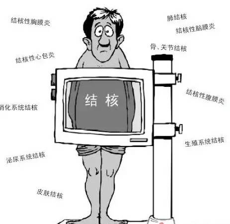 肺结核科普短视频素材,医生科普肺结核分哪些类型