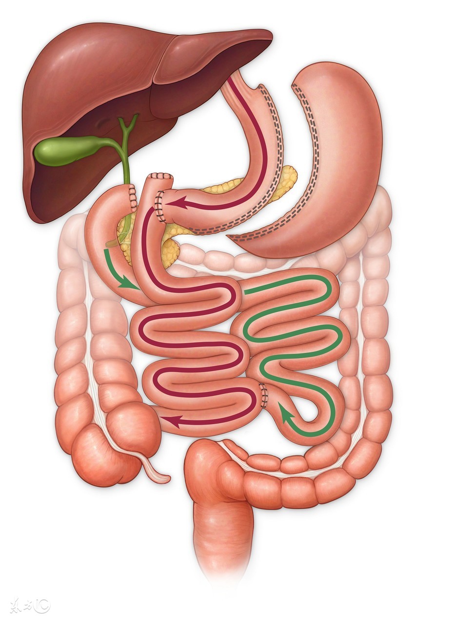 得了胆囊癌会出现哪些明显症状