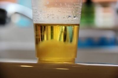 孕期小便颜色发黄是什么原因？据说，跟胎儿的性别有关系！