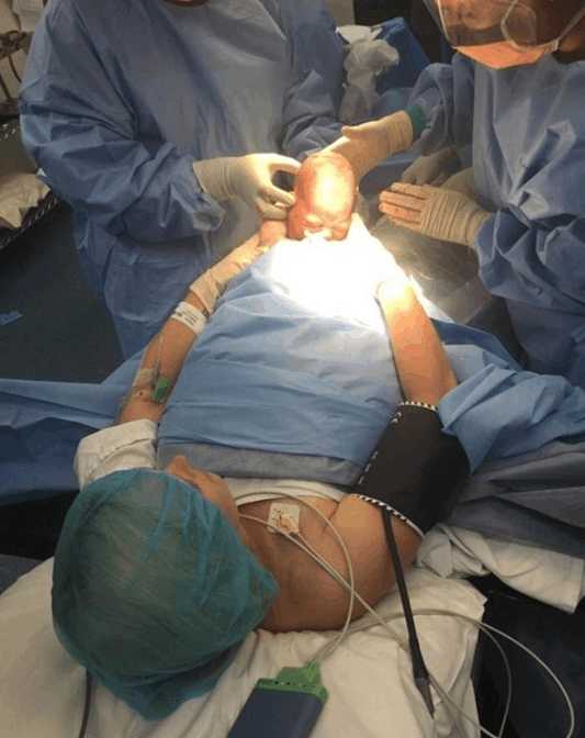 剖腹产妈妈的真实感受,剖腹产的真实感受