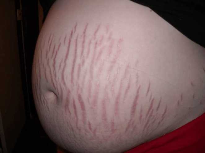 剖腹产妈妈的真实感受,剖腹产的真实感受