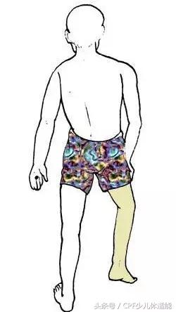 肌张力高的脑瘫患儿康复手法,脑瘫儿童肌张力高能治好吗