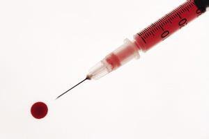 体检时报告说尿胆原偏高,总胆红素偏高