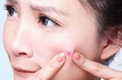 脸上起一片沙粒小疙瘩不痛不痒,天热脸上就长小疙瘩不痛不痒咋办