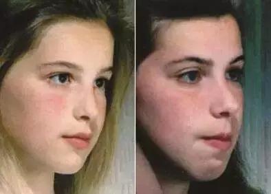 鼻炎漫画视频,过敏性鼻炎科普小视频漫画