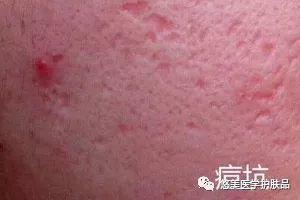 鑸掑┓鎶よ偆,鑸掑┓绁涚棙