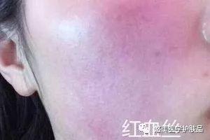 鑸掑┓鎶よ偆,鑸掑┓绁涚棙