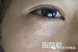 鑸掑┓鎶よ偆,鑸掑┓绁涚棙