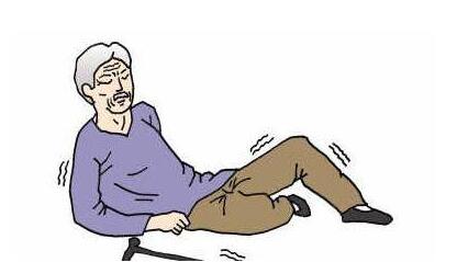 股骨头坏死有麻木的感觉,股骨头坏死会导致屁股麻木吗