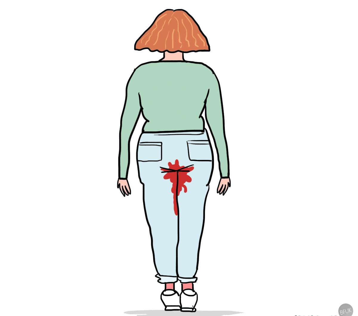 妇一科疾病自检大全,妇科疾病自检大全图解