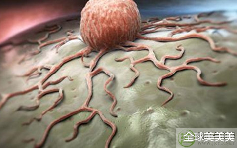 血糖一天高一天低怎么回事,老人血糖低吃什么补得最快