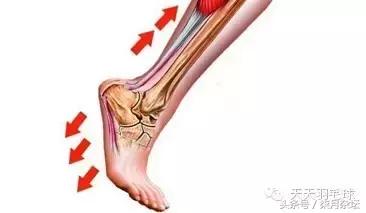 羽毛球跟腱断裂需要多久恢复,羽毛球跟腱杀手