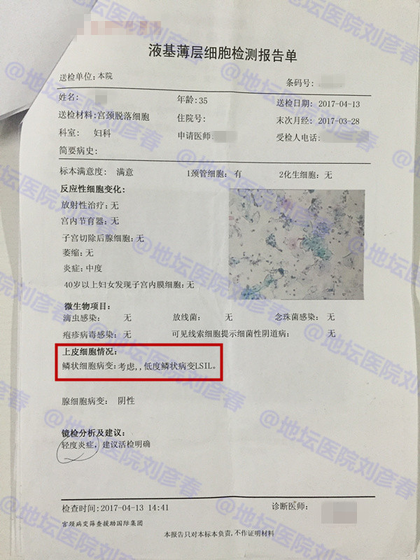 尖锐性湿疣会宫颈病变吗,宫颈炎会造成尖锐湿疣吗