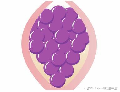 导致孕早期阴道出血的原因，除了流产还有啥？