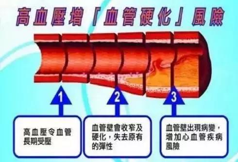 拍打上焦可以降血压吗,拍打降血压有用吗