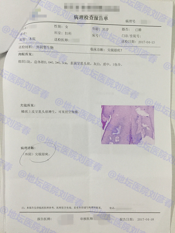 尖锐性湿疣会宫颈病变吗,宫颈炎会造成尖锐湿疣吗