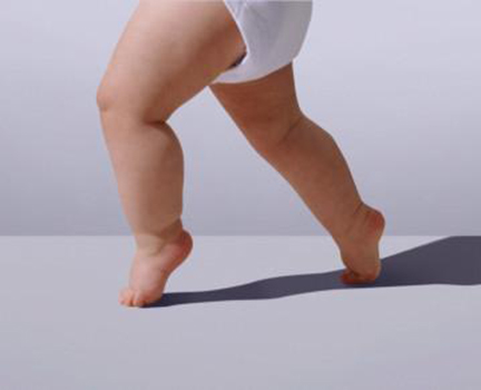 孩子异常走路步态,孩子步态异常家长您留意了吗