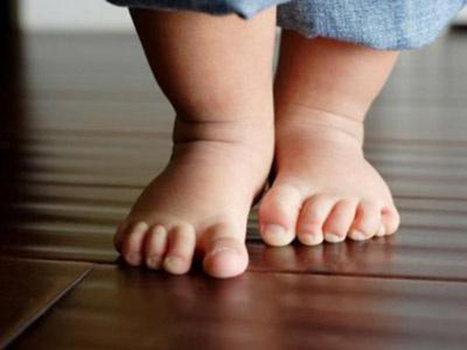 孩子异常走路步态,孩子步态异常家长您留意了吗
