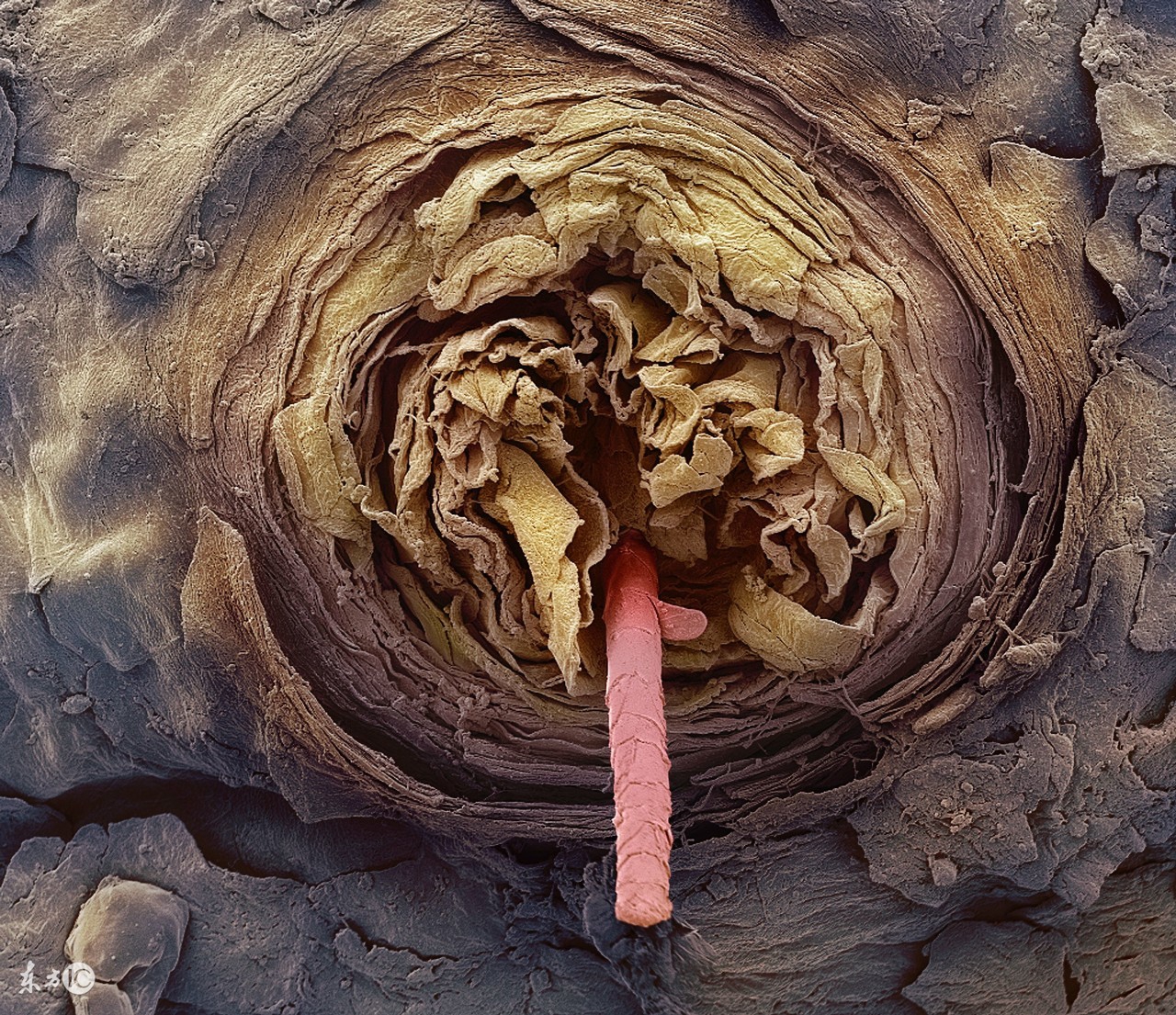 最近总是掉头发教你五招改善脱发,头发脱发发黄和缺钙有关系吗