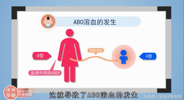 abo溶血和rh溶血区别,abo溶血和rh溶血哪个更常见