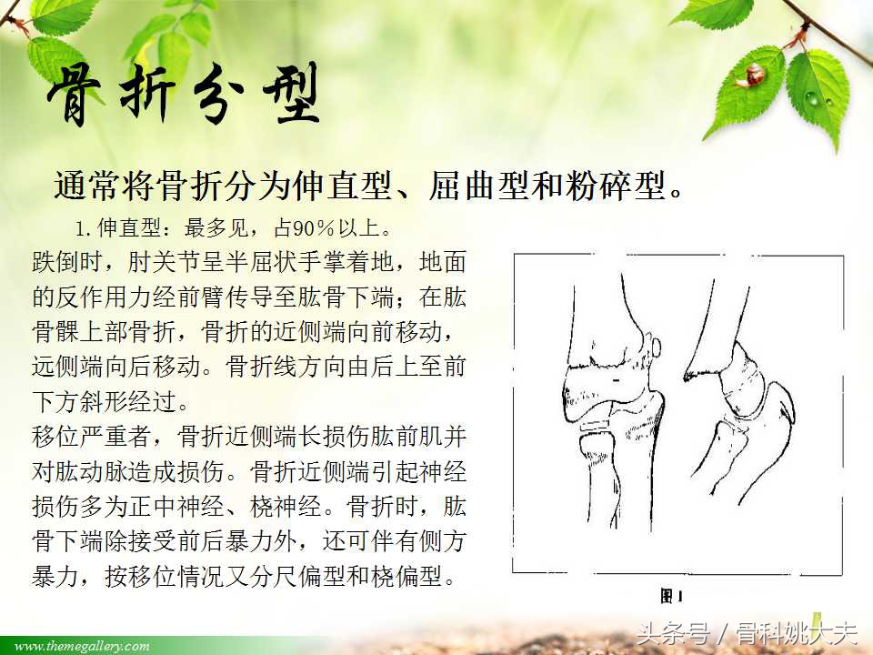 儿童肱骨干骨折处理方法,小孩胳膊肱骨骨折恢复最佳的方法