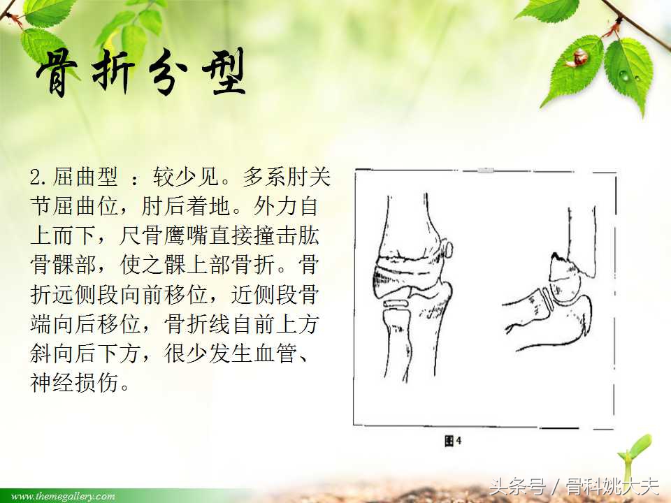 儿童肱骨干骨折处理方法,小孩胳膊肱骨骨折恢复最佳的方法