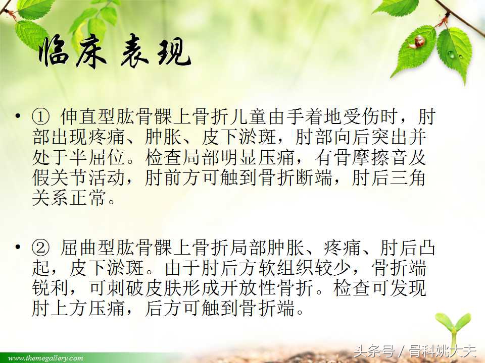 儿童肱骨干骨折处理方法,小孩胳膊肱骨骨折恢复最佳的方法