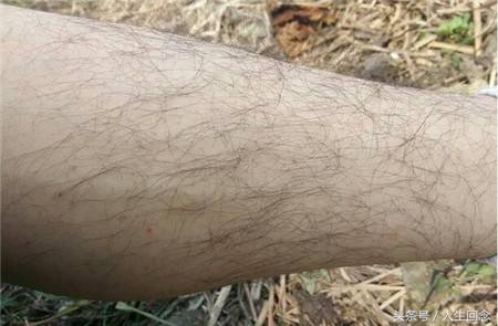 汗毛多的女生如何改善学生党,汗毛重的女生怎么调理减肥