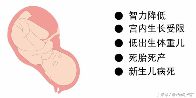 怀孕得甲减怎么办,甲减为什么很难怀孕