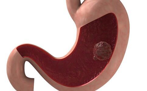 中医胃病吃什么食物养胃,如何养胃根治胃病最有效