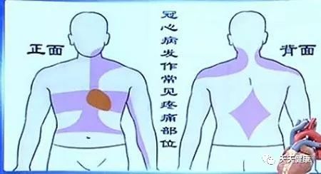 冠心病介入治疗是什么,安贞医院冠心病介入治疗新技术