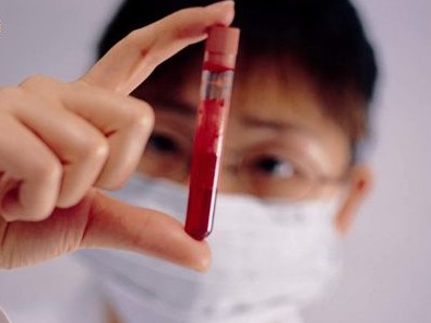 桥本氏病为什么难治,桥本病是什么病永远好不了吗