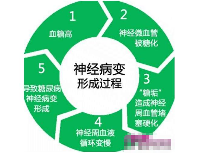 糖友抗糖的好方法,如何预防糖尿病神经病变