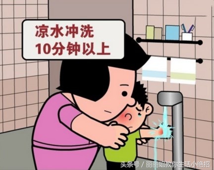 不小心烫伤了要涂什么药,不小心烫伤要怎么样才可以不烫